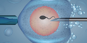 IVF Treatment Services